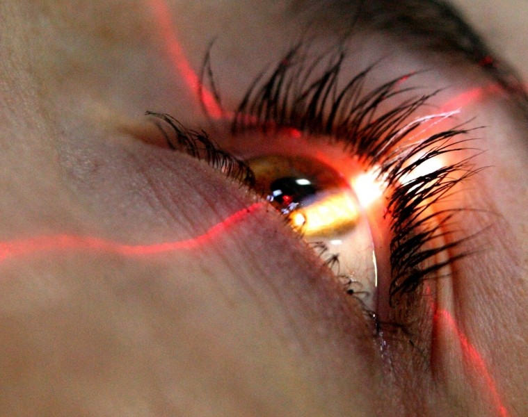 Лазерная коррекция зрения — об операции, противопоказаниях, последствиях