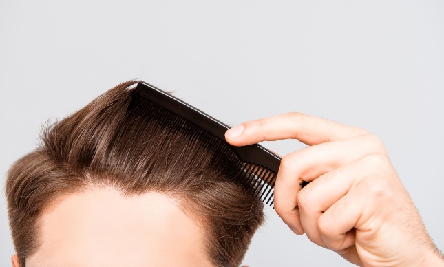 Вживление волос: миф или успешный способ борьбы с облысением?