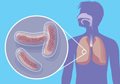 Методы диагностики туберкулеза: от аппаратных подходов до лабораторных анализов