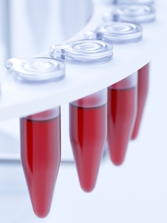 Самостоятельная расшифровка результатов общего анализа крови — возможна ли?