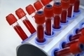Самостоятельная расшифровка результатов общего анализа крови — возможна ли?