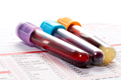 Анализы на белки: от многообразия исследований до специфики анализа общего белка в сыворотке крови