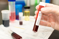 Ключевые методы лабораторной диагностики распространенных инфекций