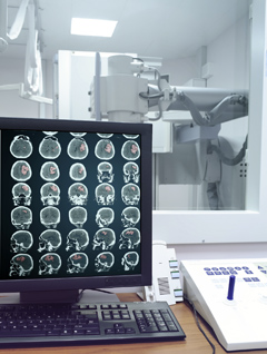 КТ головного мозга: показания к проведению, особенности процедуры и интерпретация результатов исследования