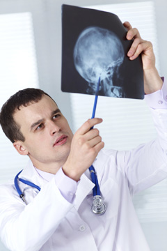 Рентген головы: когда назначается, как проводится и что показывает исследование?